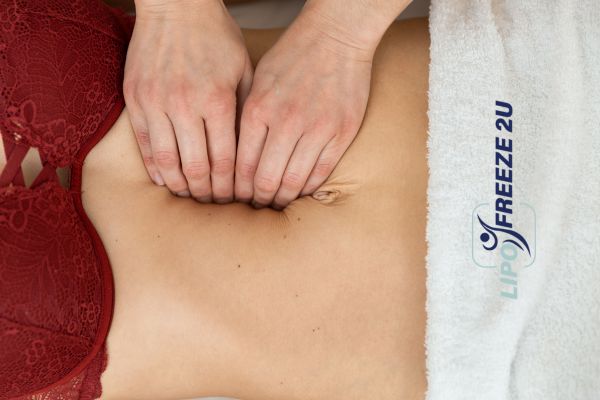 diastasis recti treatment Weymouth