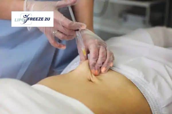 How Does Aqualyx Fat Dissolving Injection Work to Break Down Fat Weymouth?