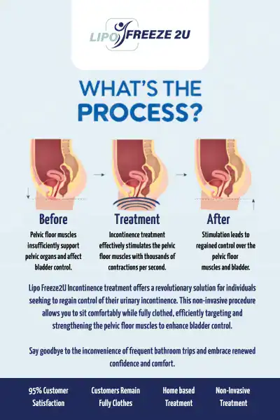 Diagram of how incontinence treatment Weymouth works.