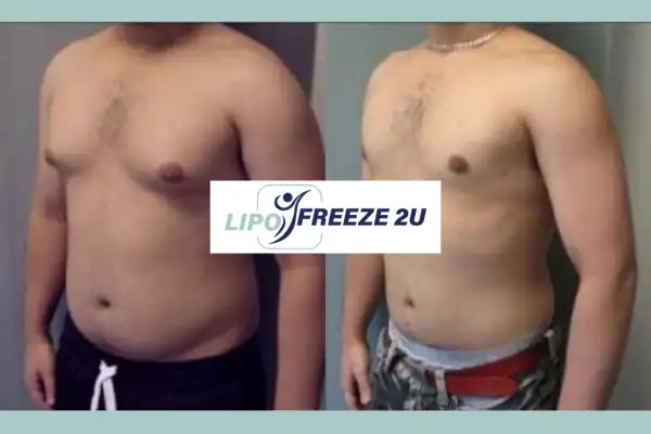 How Long Does It Take to See Results Weymouth?