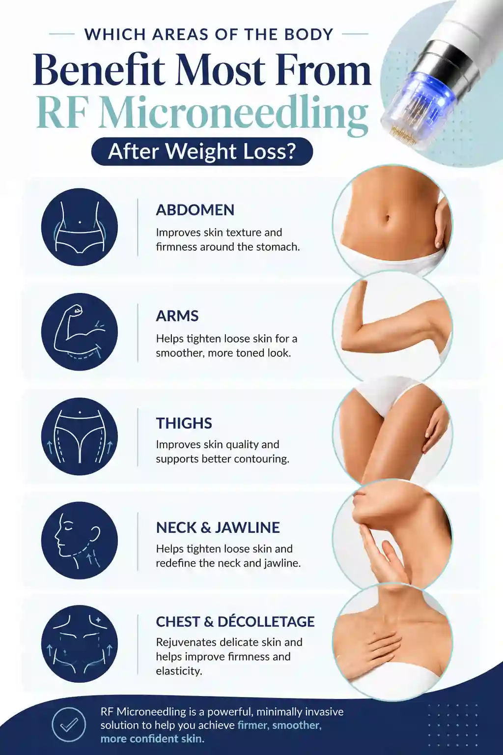 Which Areas of the Body Benefit Most From RF Microneedling After Weight Loss Weymouth